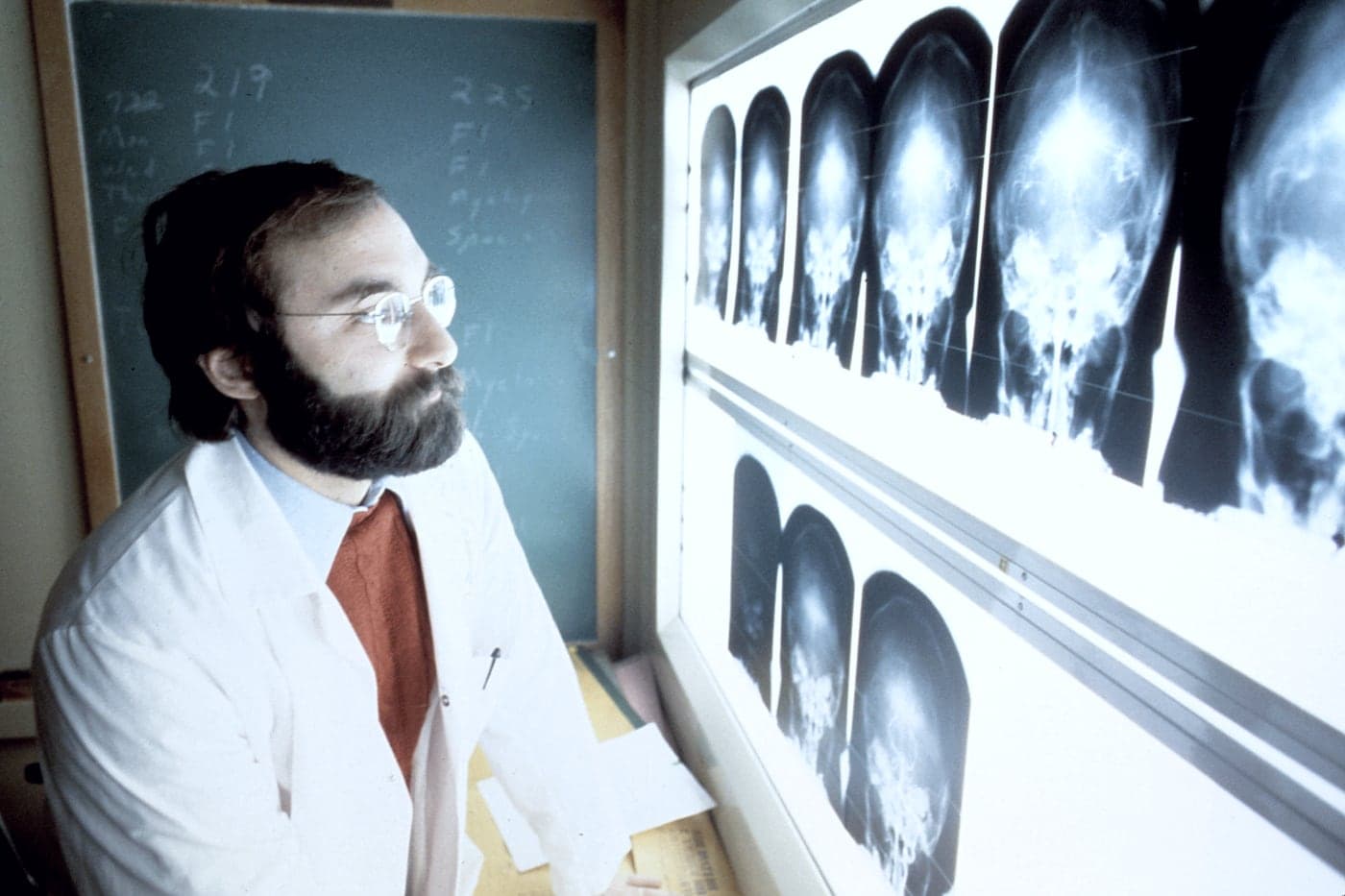Physician reviewing skull X-ray images